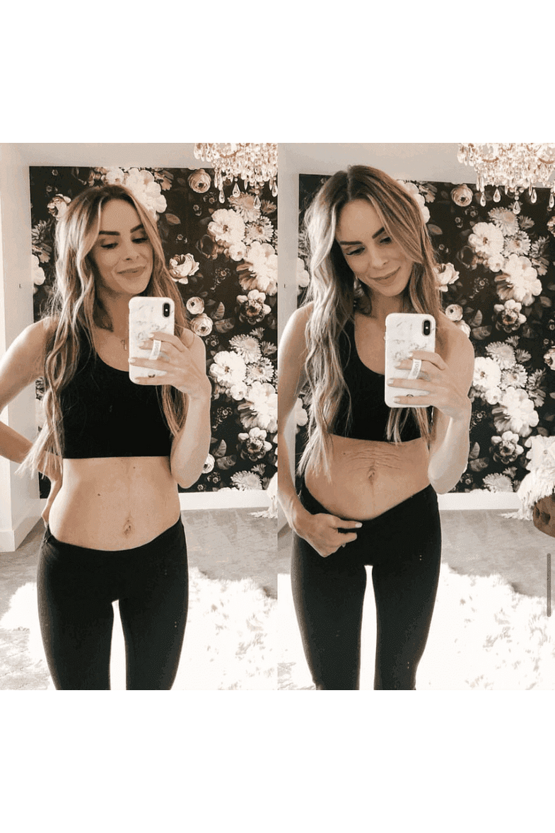 Tummy Butter Postpartum Stretch Mark Cream - SwagglyLife Home & Fashion